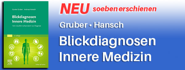NEU! 