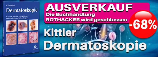Jetzt 68% günstiger!