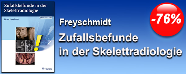 76% günstiger!